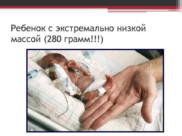 Ребенок с экстремально низкой массой (280 грамм!!!) 