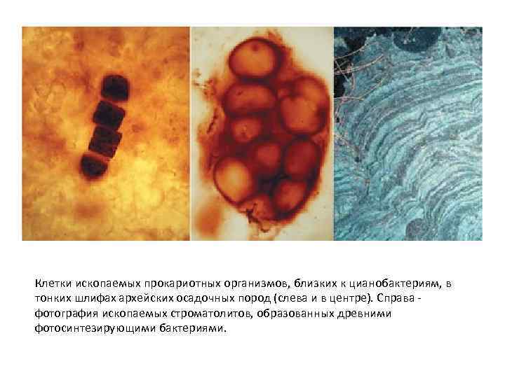 Клетки ископаемых прокариотных организмов, близких к цианобактериям, в тонких шлифах архейских осадочных пород (слева