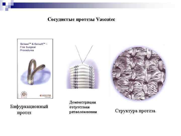 Cосудистые протезы Vascutec Бифуркационный протез Демонстрация отсутствия разволокнения Cтруктура протеза 