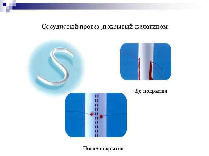 Сосудистый протез , покрытый желатином До покрытия После покрытия 
