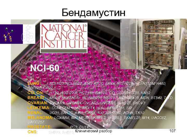 Бендамустин NCI-60 LUNG: NCI-H 23, NCI-H 522, A 549 -ATCC, EKVX, NCI-H 226, NCI-H