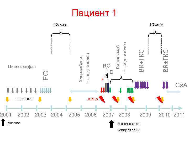 Пациент 1 BR±ГКС BR+ГКС RC D P F Ритуксимаб ± преднизолон FC Циклофосфан 13