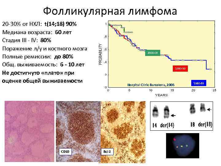 Диффузная в клеточная лимфома клинические рекомендации. Фолликулярная лимфома. Фолликулярная неходжкинская лимфома. Фолликулярная лимфома 4 стадии. Фолликулярная лимфома Grade.