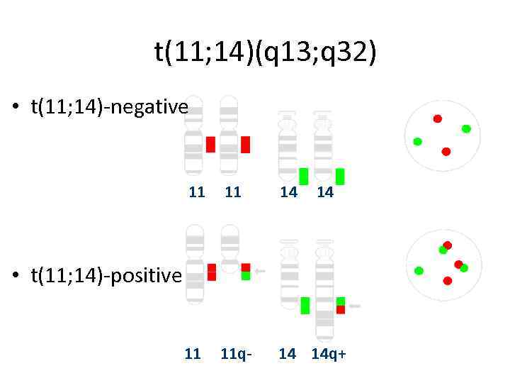 t(11; 14)(q 13; q 32) • t(11; 14)-negative 11 11 14 14 11 11