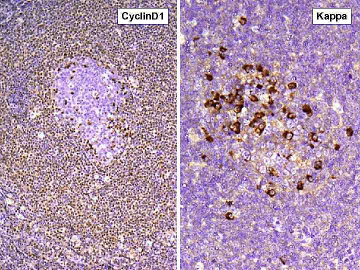 Cyclin. D 1 Kappa 