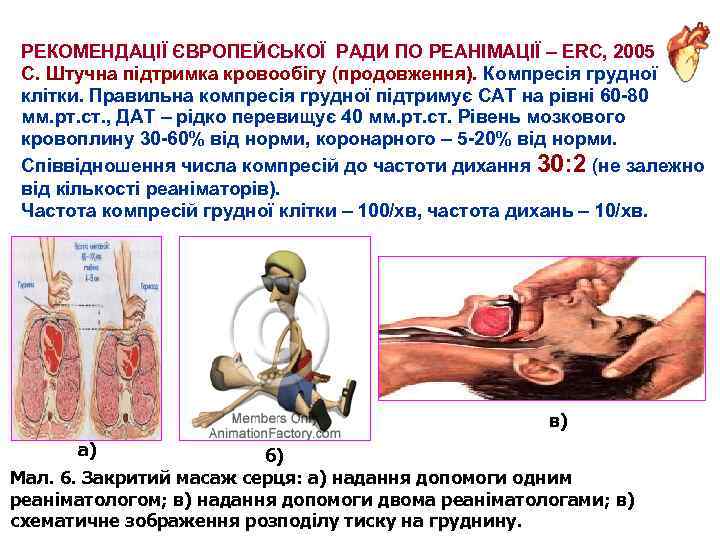 РЕКОМЕНДАЦІЇ ЄВРОПЕЙСЬКОЇ РАДИ ПО РЕАНІМАЦІЇ – ERC, 2005 С. Штучна підтримка кровообігу (продовження). Компресія