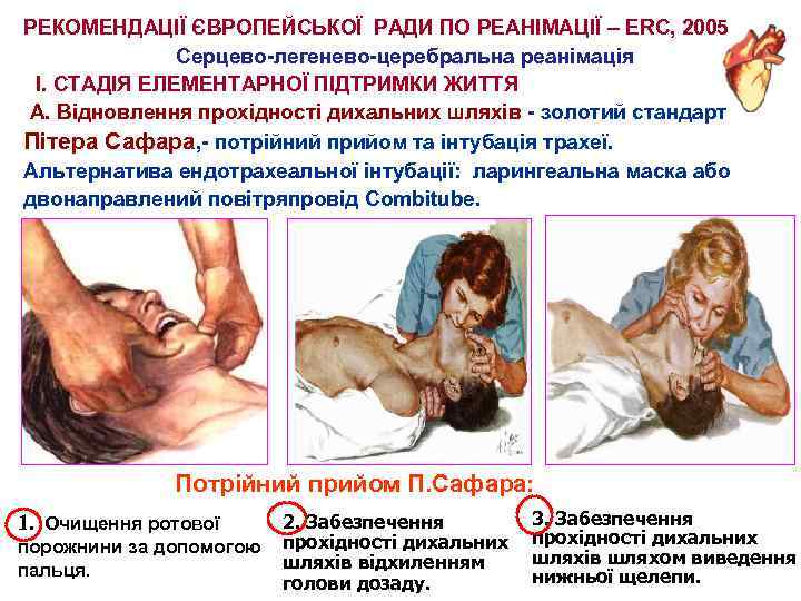 РЕКОМЕНДАЦІЇ ЄВРОПЕЙСЬКОЇ РАДИ ПО РЕАНІМАЦІЇ – ERC, 2005 Серцево-легенево-церебральна реанімація І. СТАДІЯ ЕЛЕМЕНТАРНОЇ ПІДТРИМКИ