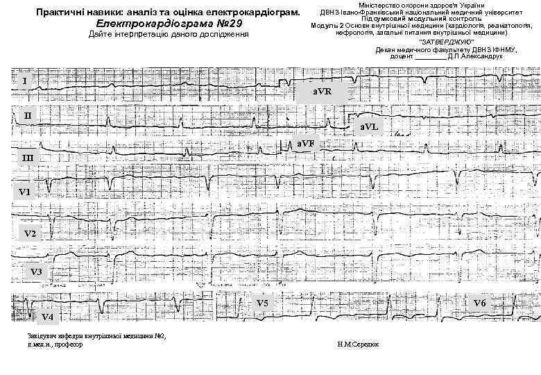 Практичні навики: аналіз та оцінка електрокардіограм. Електрокардіограма № 29 Дайте інтерпретацію даного дослідження І