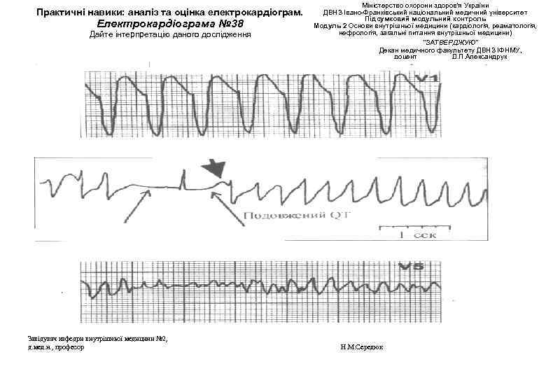 Практичні навики: аналіз та оцінка електрокардіограм. Електрокардіограма № 38 Дайте інтерпретацію даного дослідження Завідувач