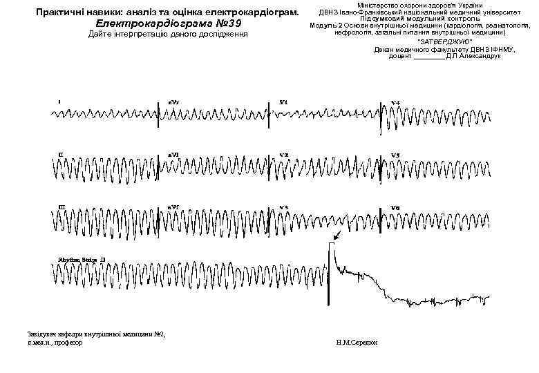 Практичні навики: аналіз та оцінка електрокардіограм. Електрокардіограма № 39 Дайте інтерпретацію даного дослідження Завідувач