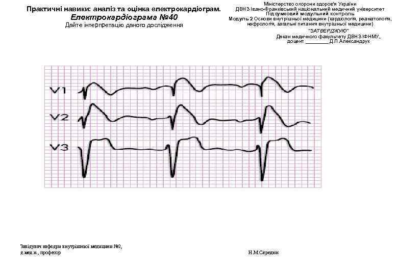 Практичні навики: аналіз та оцінка електрокардіограм. Електрокардіограма № 40 Дайте інтерпретацію даного дослідження Завідувач