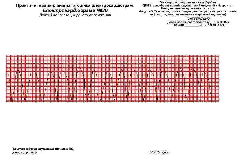Практичні навики: аналіз та оцінка електрокардіограм. Електрокардіограма № 30 Дайте інтерпретацію даного дослідження Завідувач