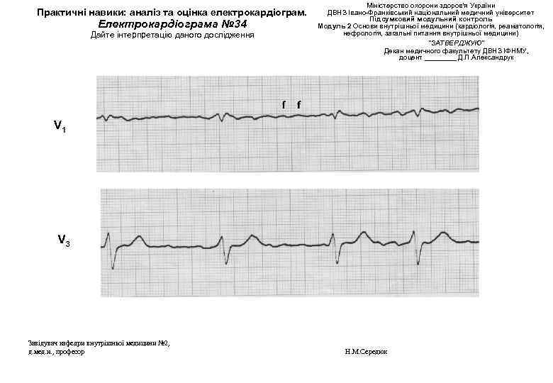 Практичні навики: аналіз та оцінка електрокардіограм. Електрокардіограма № 34 Дайте інтерпретацію даного дослідження Завідувач