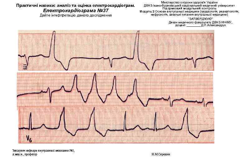 Практичні навики: аналіз та оцінка електрокардіограм. Електрокардіограма № 37 Дайте інтерпретацію даного дослідження Завідувач