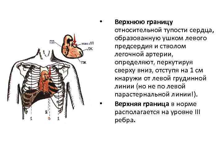 Сердечная тупость. Перкуссия границ относительной сердечной тупости. Границы относительной тупости сердца перкуссия. Перкуссия сердца Относительная тупость сердца. Перкуссия верхней границы относительной тупости сердца.