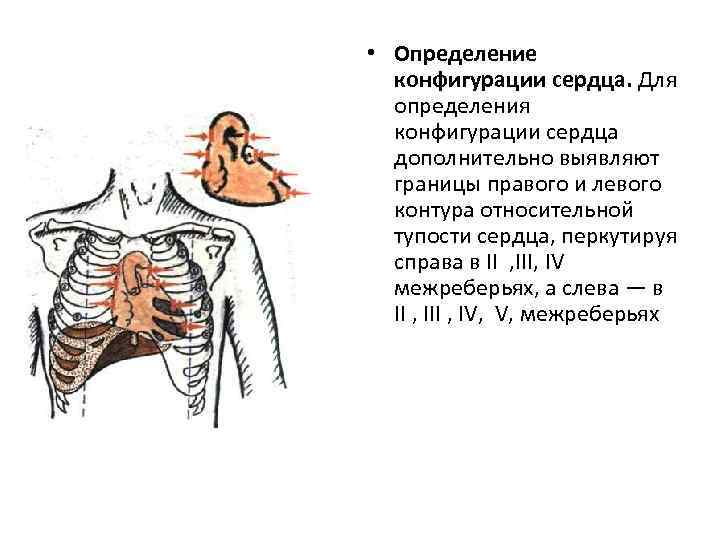  • Определение конфигурации сердца. Для определения конфигурации сердца дополнительно выявляют границы правого и