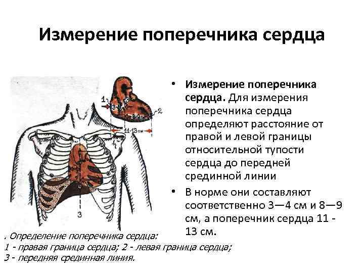 Поперечник