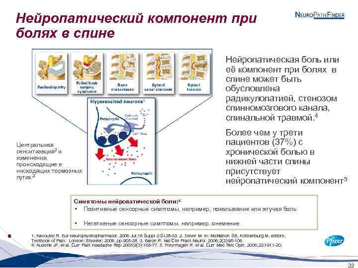 Нейропатический компонент при болях в спине Нейропатическая боль или её компонент при болях в