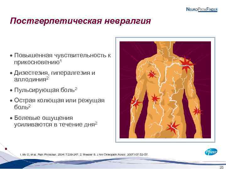 Постгерпетическая невралгия · Повышенная чувствительность к прикосновению1 · Дизестезия, гипералгезия и аллодиния 2 ·