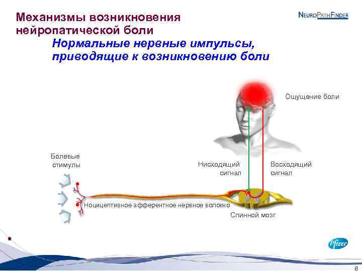 Механизмы возникновения нейропатической боли Нормальные нервные импульсы, приводящие к возникновению боли Ощущение боли Болевые