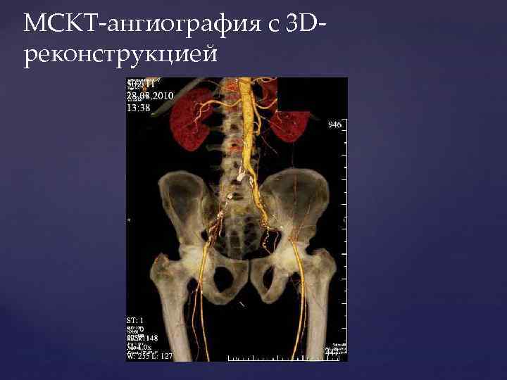 Заболевание сосудов нижних конечностей фото