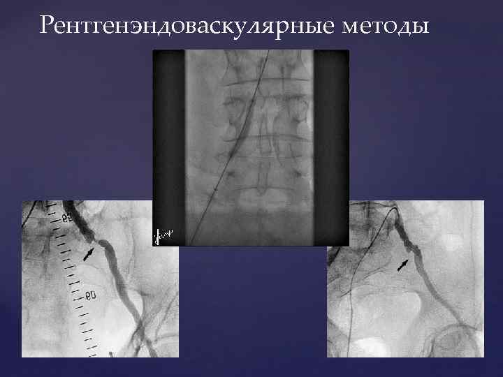 Рентгенэндоваскулярная диагностика презентация