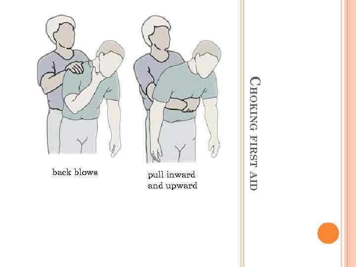 pull inward and upward CHOKING FIRST AID back blows 