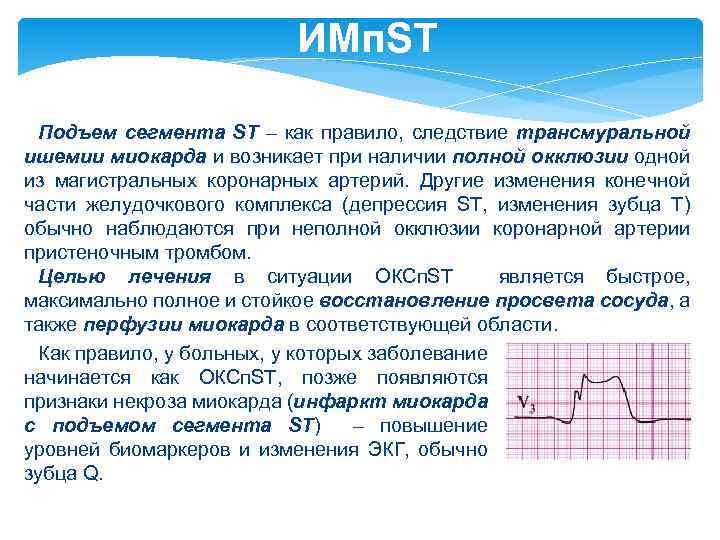 ИМп. ST Подъем сегмента ST – как правило, следствие трансмуральной ишемии миокарда и возникает