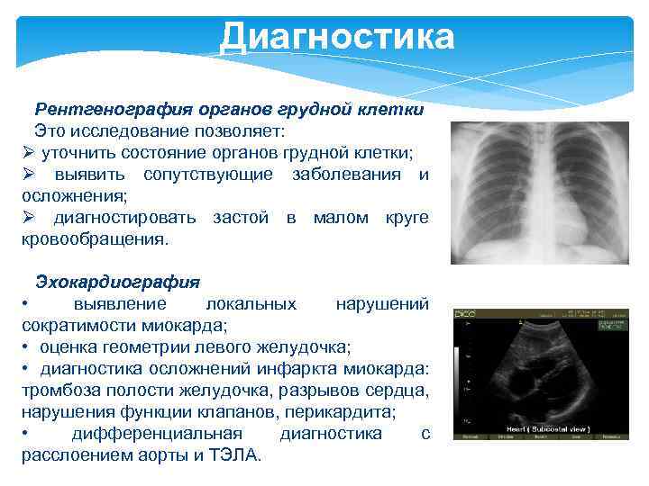 Диагностика Рентгенография органов грудной клетки Это исследование позволяет: Ø уточнить состояние органов грудной клетки;