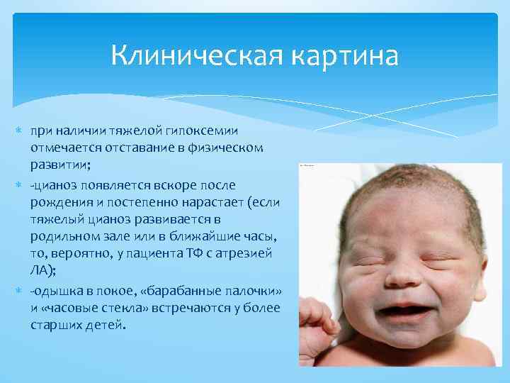 Клиническая картина при наличии тяжелой гипоксемии отмечается отставание в физическом развитии; -цианоз появляется вскоре