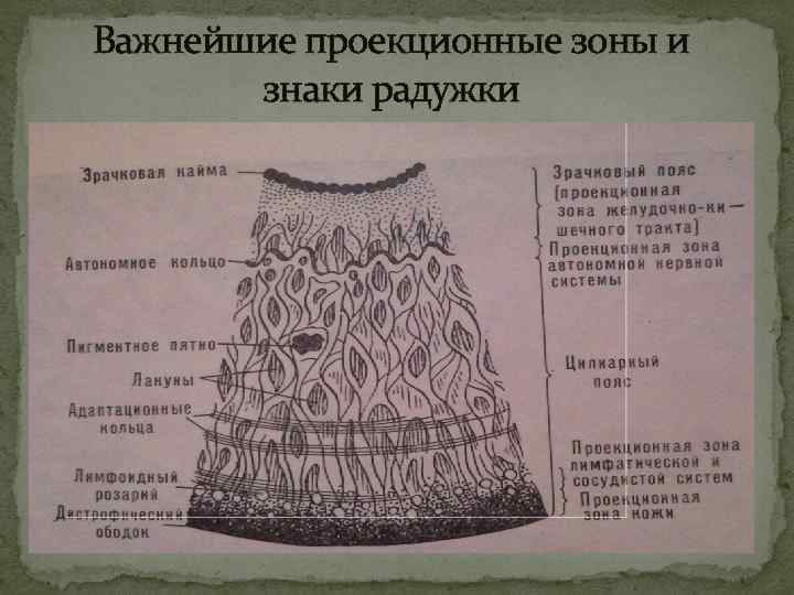 Важнейшие проекционные зоны и знаки радужки 