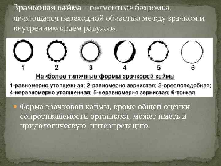 Зрачковая кайма – пигментная бахромка, являющаяся переходной областью между зрачком и внутренним краем радужки.