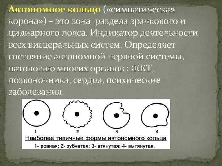 Автономное кольцо ( «симпатическая корона» ) – это зона раздела зрачкового и цилиарного пояса.