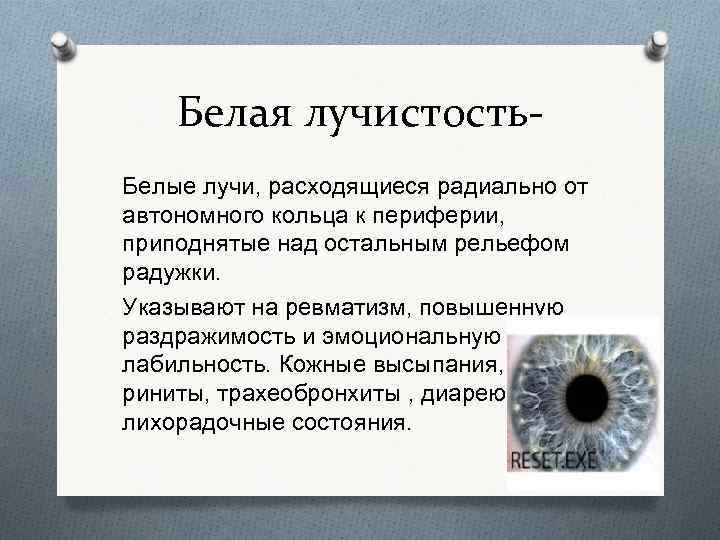 Белая лучистость Белые лучи, расходящиеся радиально от автономного кольца к периферии, приподнятые над остальным