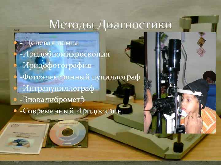 Методы Диагностики Щелевая лампа Иридобиомикроскопия Иридофотография Фотоэлектронный пупиллограф Интрапупиллограф Биокалиброметр Современный Иридоскрин 