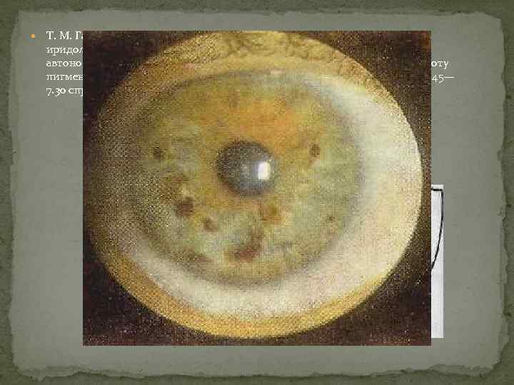  Т. М. Ганич (1990), исследовавший 102 больных, ус тановил следующие иридологические знаки при