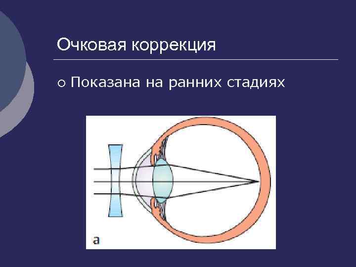 Очковая коррекция ¡ Показана на ранних стадиях 