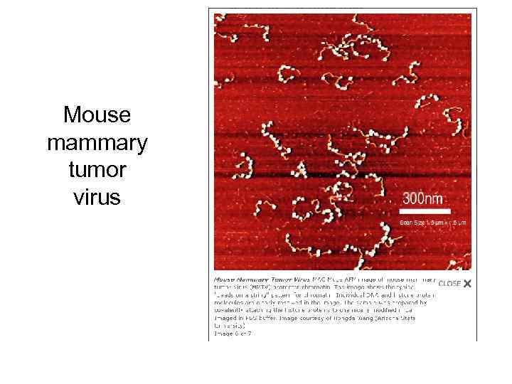 Mouse mammary tumor virus 