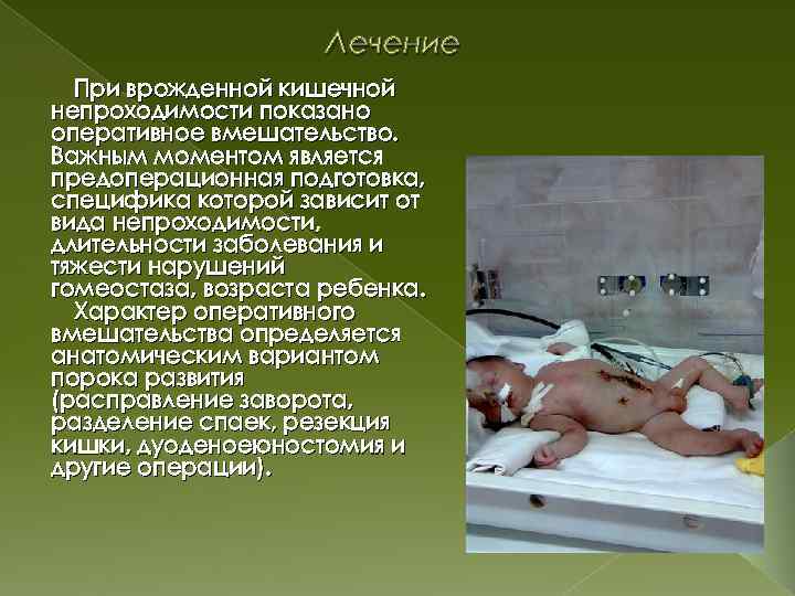 Лечение При врожденной кишечной непроходимости показано оперативное вмешательство. Важным моментом является предоперационная подготовка, специфика