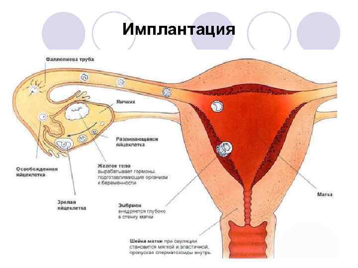 Имплантация 