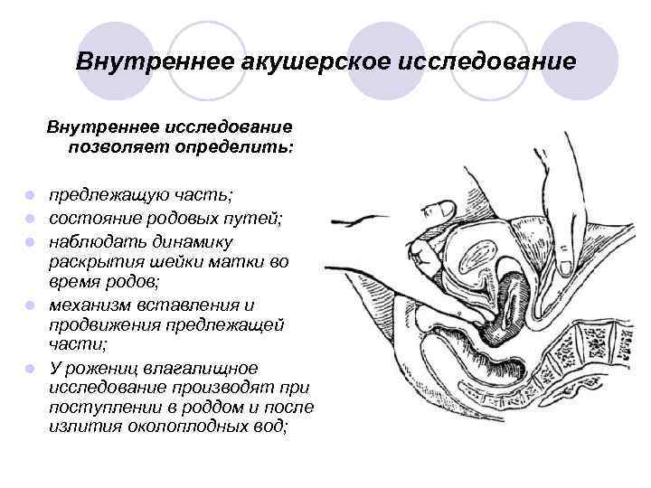 Акушерское исследование