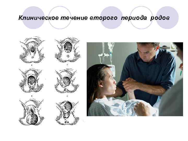 Клиническое течение второго периода родов 