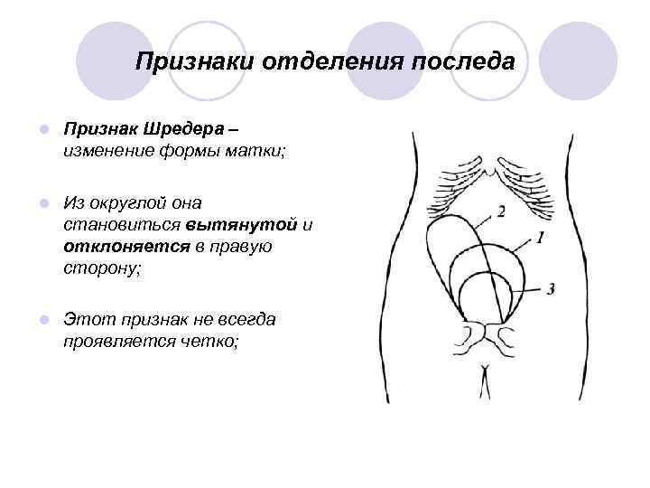 Признаки отделения последа l Признак Шредера – изменение формы матки; l Из округлой она
