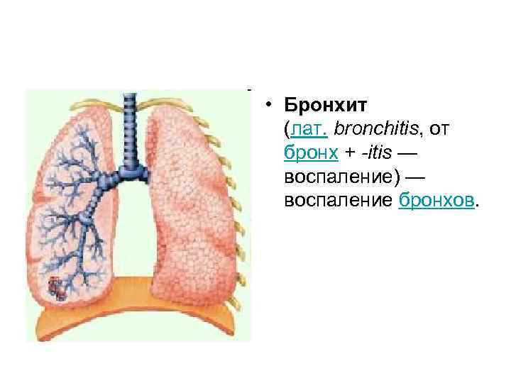 Острый бронхит аускультативно