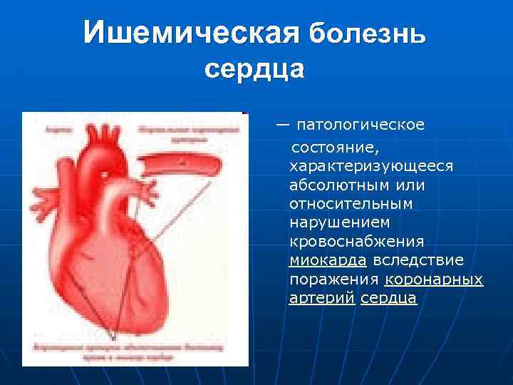 Ишемическая болезнь сердца — патологическое состояние, характеризующееся абсолютным или относительным нарушением кровоснабжения миокарда вследствие