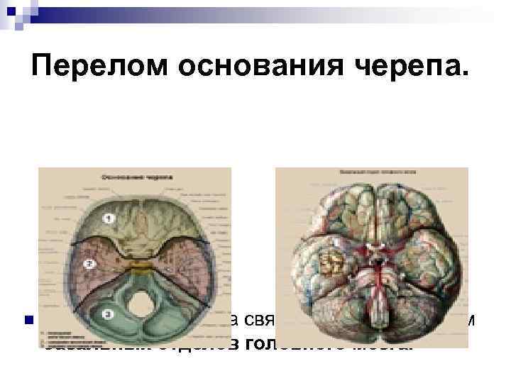 Клиническая картина переломов