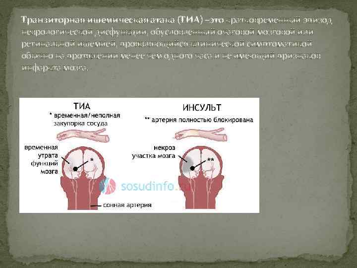 Карта вызова смп транзиторная ишемическая атака