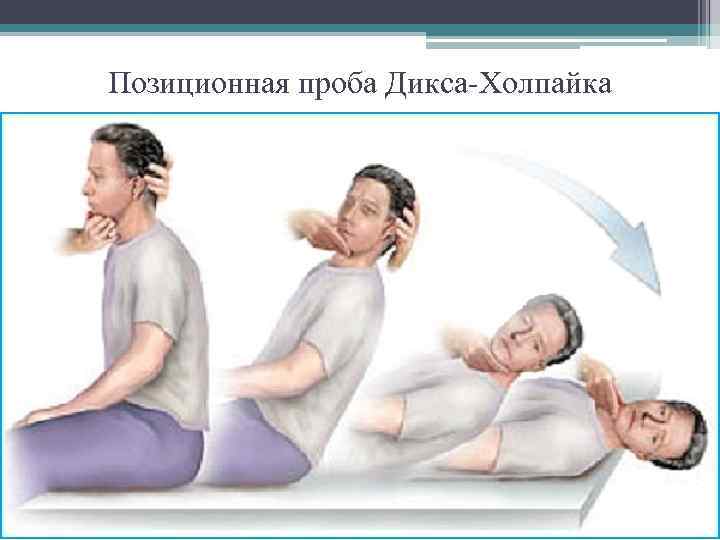 Позиционная проба Дикса-Холпайка 