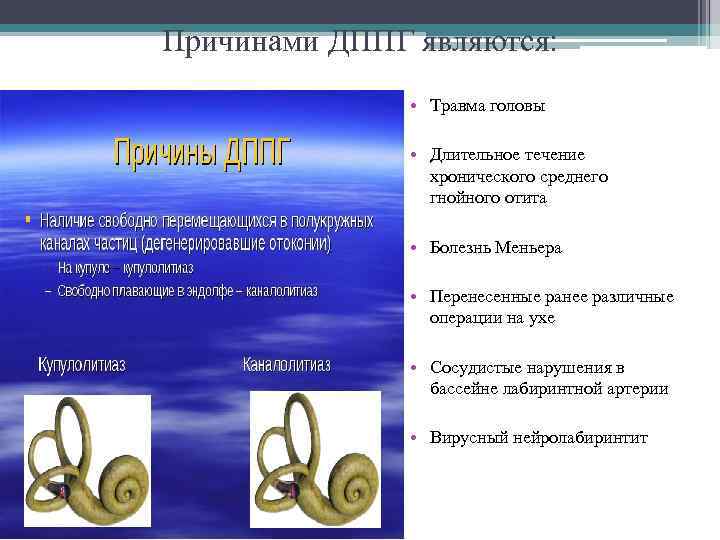 Причинами ДППГ являются: • Травма головы • Длительное течение хронического среднего гнойного отита •