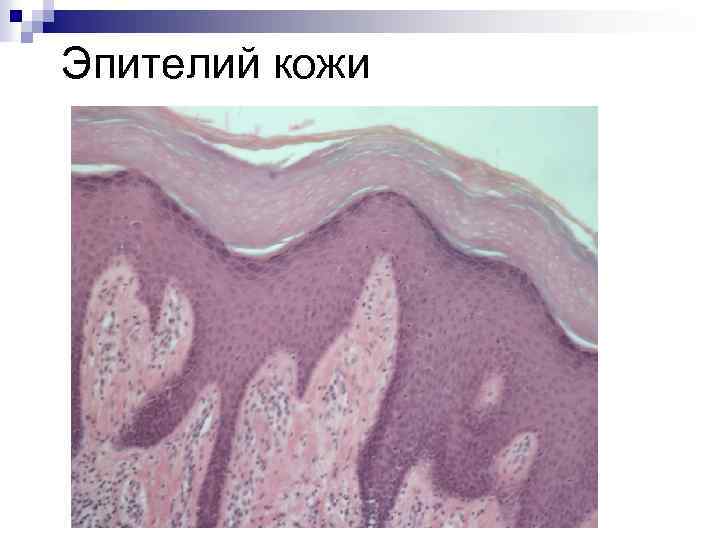 Эпителий кожи 